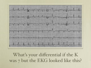 What’s your diﬀerential if the K
was 7 but the EKG looked like this?
 