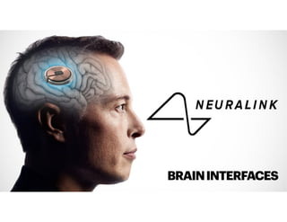BRAININTERFACES
 