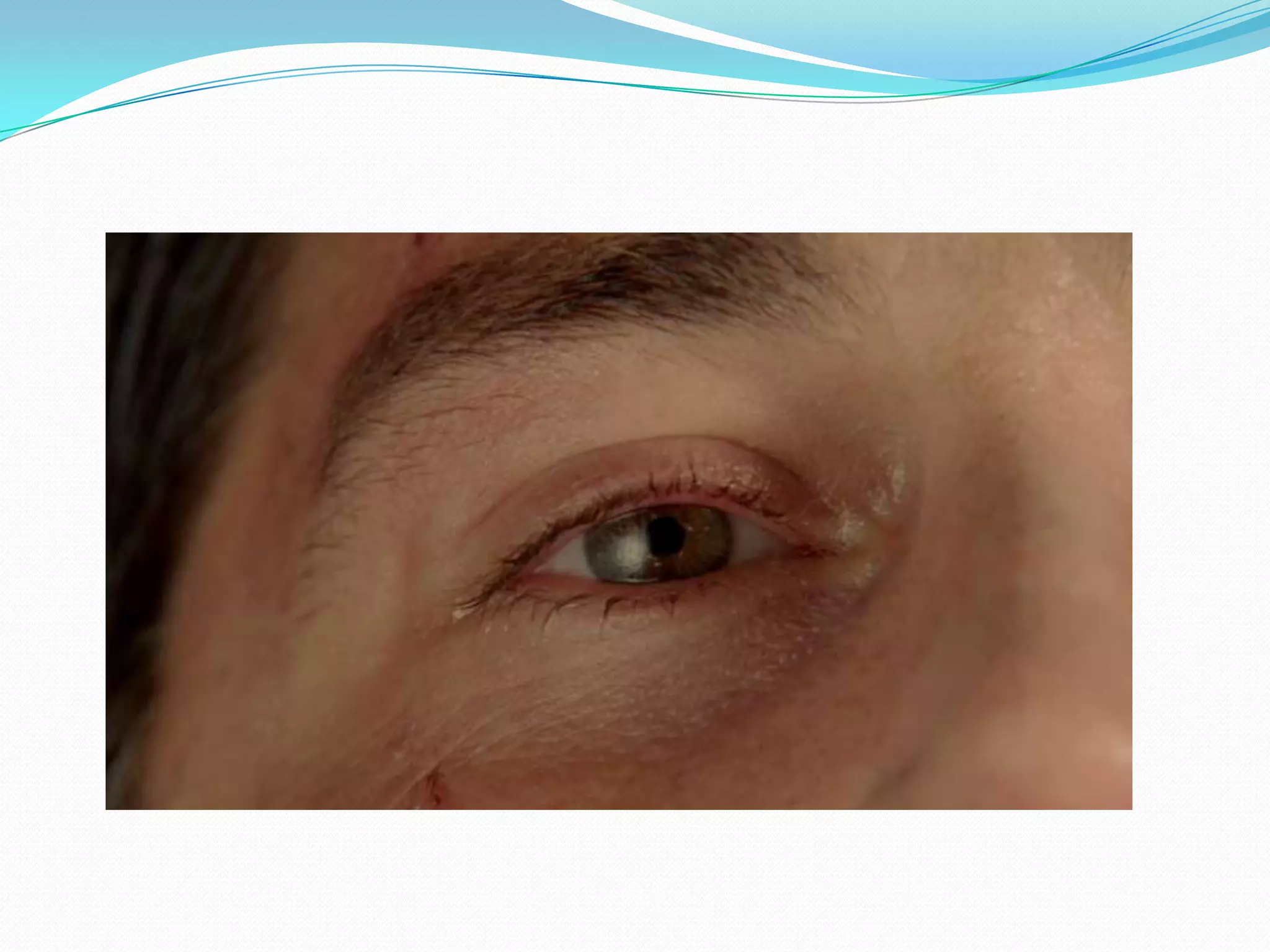 What the heck is "Lost"?