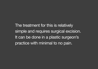 The treatment for this is relatively
simple and requires surgical excision.
It can be done in a plastic surgeon’s
practice with minimal to no pain.
 