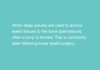 When deep sutures are used to anchor
eyelid tissues to the bone (periosteum),
often a lump is formed. This is commonly
seen following lower eyelid surgery.
 
