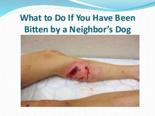 What to Do If You Have Been
Bitten by a Neighbor’s Dog
 
