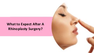 What to Expect After A
Rhinoplasty Surgery?
 