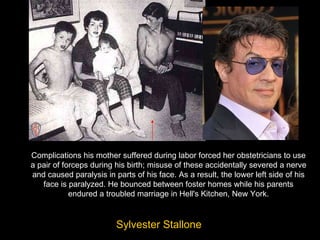 Complications his mother suffered during labor forced her obstetricians to use a pair of forceps during his birth; misuse of these accidentally severed a nerve and caused paralysis in parts of his face. As a result, the lower left side of his face is paralyzed. He bounced between foster homes while his parents endured a troubled marriage in Hell's Kitchen, New York. Sylvester Stallone   