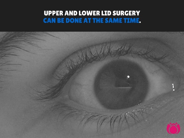 What You Need to Know About Eye Lid Surgery | PPT