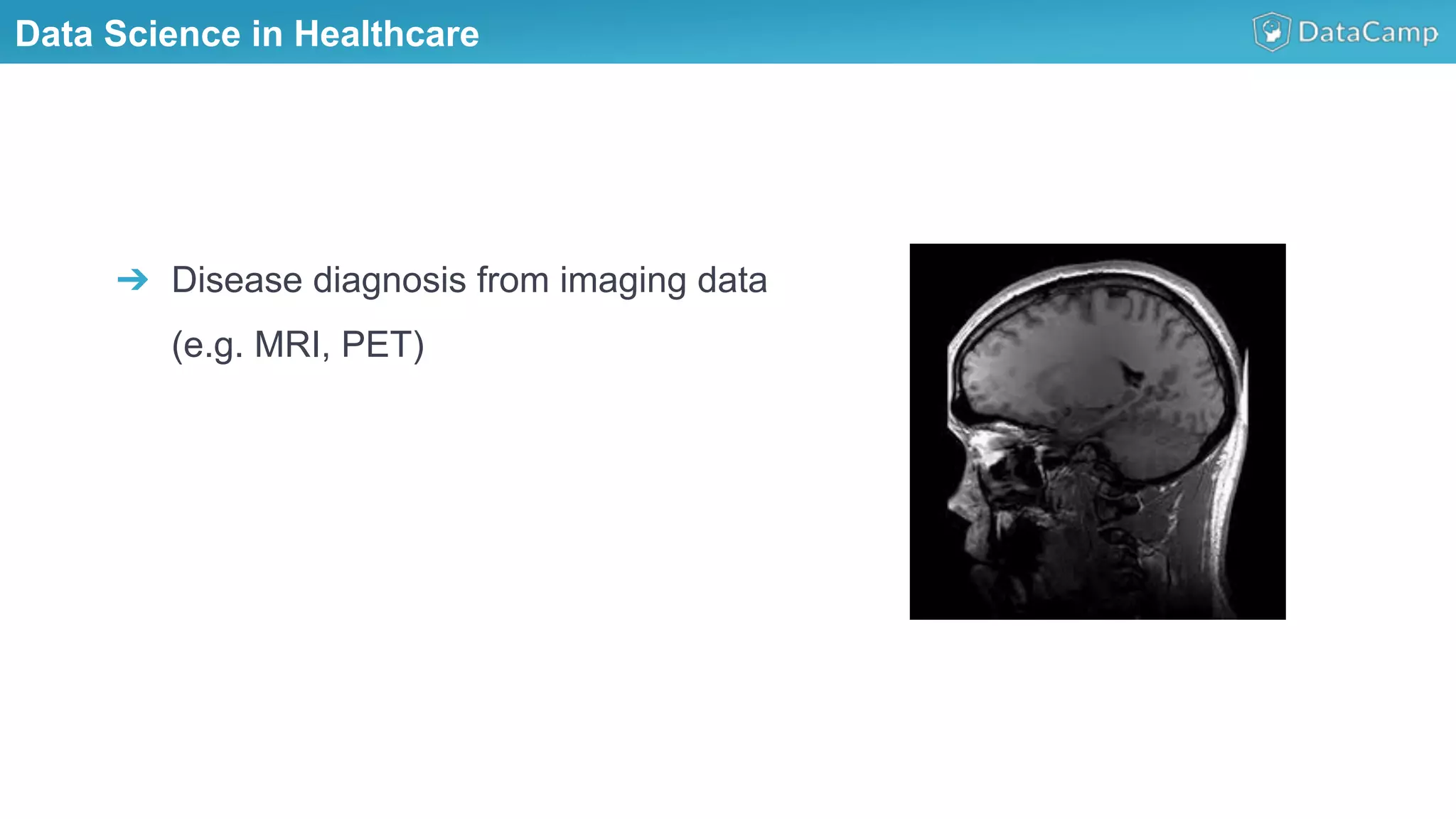 Data Science in Healthcare
➔  Disease diagnosis from imaging data
(e.g. MRI, PET)
 