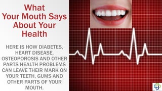What
Your Mouth Says
About Your
Health
HERE IS HOW DIABETES,
HEART DISEASE,
OSTEOPOROSIS AND OTHER
PARTS HEALTH PROBLEMS
CAN LEAVE THEIR MARK ON
YOUR TEETH, GUMS AND
OTHER PARTS OF YOUR
MOUTH.
 
