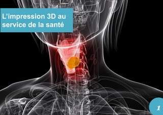 L’impression 3D au
service de la santé
1
 