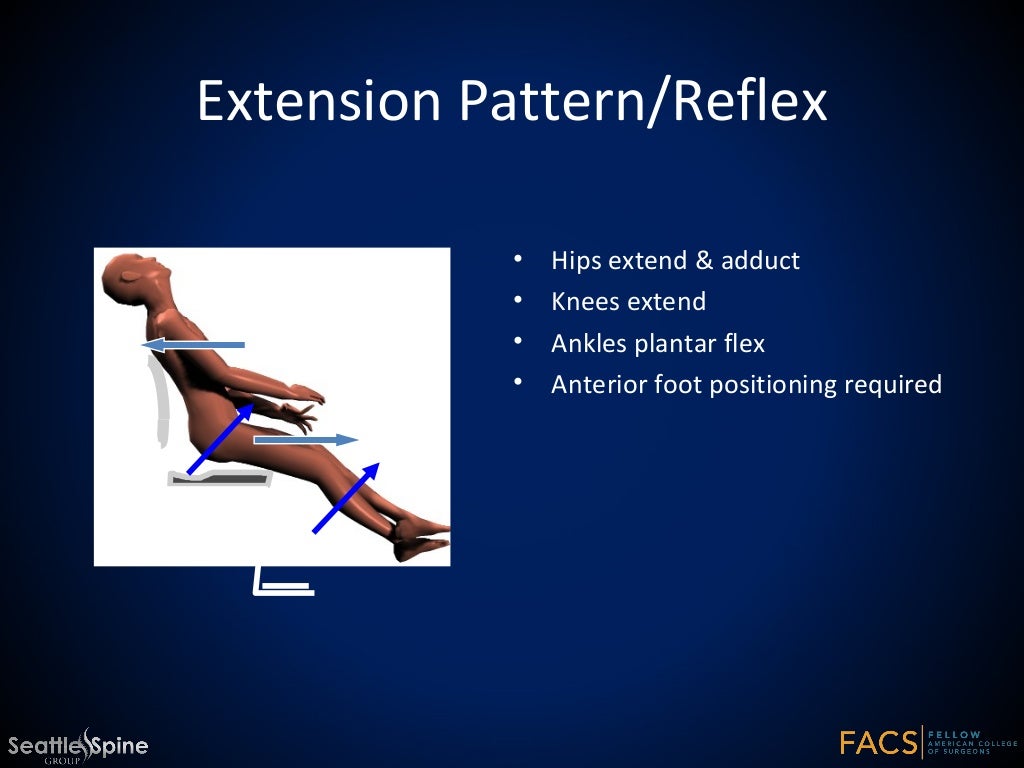 Neuromuscular Scoliosis in Cerebral Palsy Wheelchair fitting a child
