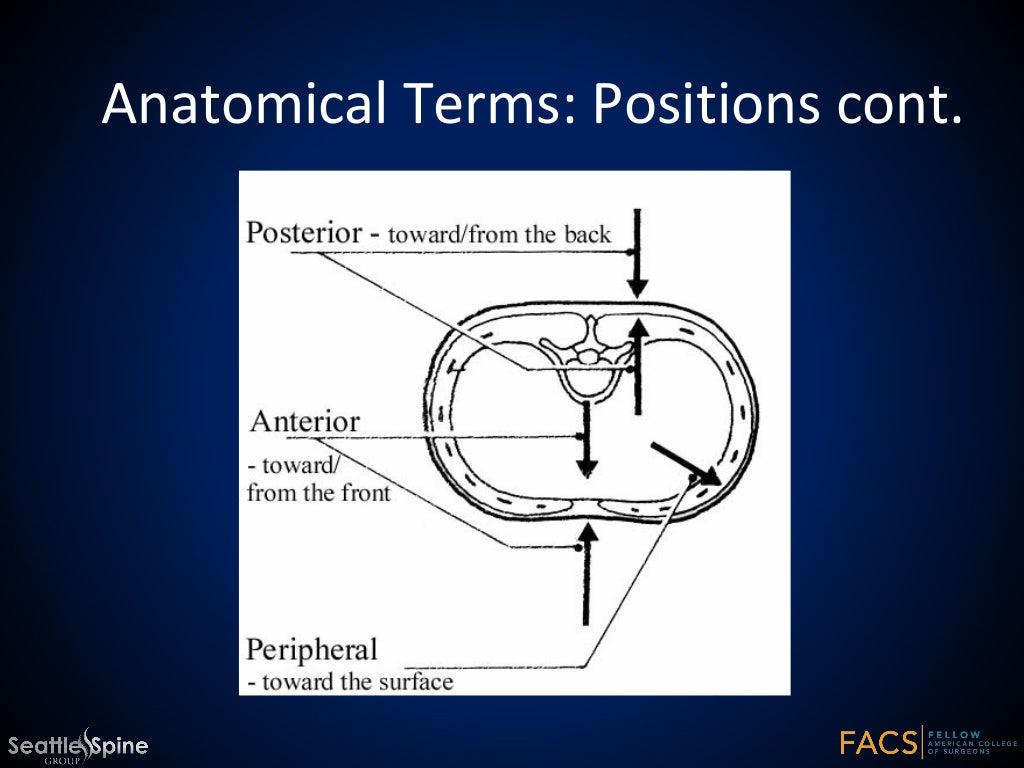 Neuromuscular Scoliosis in Cerebral Palsy Wheelchair fitting a child