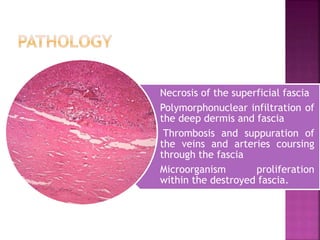 Necrosis of the superficial fascia
Polymorphonuclear infiltration of
the deep dermis and fascia
Thrombosis and suppuration of
the veins and arteries coursing
through the fascia
Microorganism proliferation
within the destroyed fascia.
 