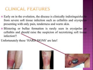  Early on in the evolution, the disease is clinically indistinguishable
from severe soft tissue infection such as cellulitis and erysipelas
presenting with only pain, tenderness and warm skin.
 Blistering or bullae formation is rarely seen in erysipelas or
cellulitis and should raise the suspicion of necrotizing soft tissue
infection!!
Unfortunately these ‘HARD SIGNS’ are late!
 