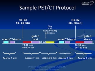 When is pet better choice than spect 2019999 | PPTX | Heart and ...