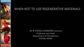 Dr R VISWA CHANDRA MDS;DNB
Professor and Head
Department of Periodontics
SVSIDS, MBNR
 