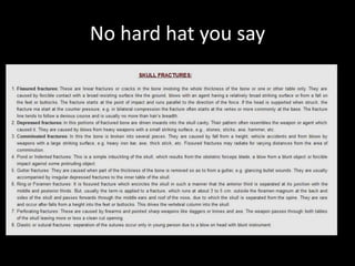 No hard hat you say
 