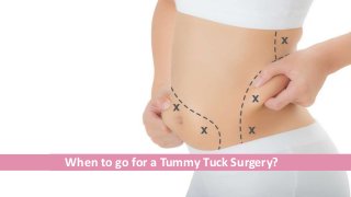When to go for a Tummy Tuck Surgery?
 