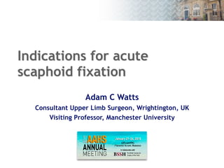 Indications for acute
scaphoid fixation
Adam C Watts
Consultant Upper Limb Surgeon, Wrightington, UK
Visiting Professor, Manchester University
1
 