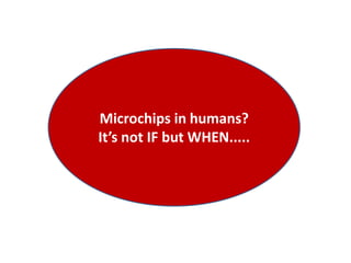 Microchips in humans?
It’s not IF but WHEN.....
 