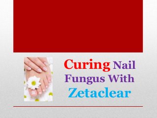 Curing Nail
Fungus With
Zetaclear
 