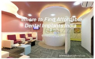 Where to Find Affordable 
Dental Implants India 
 