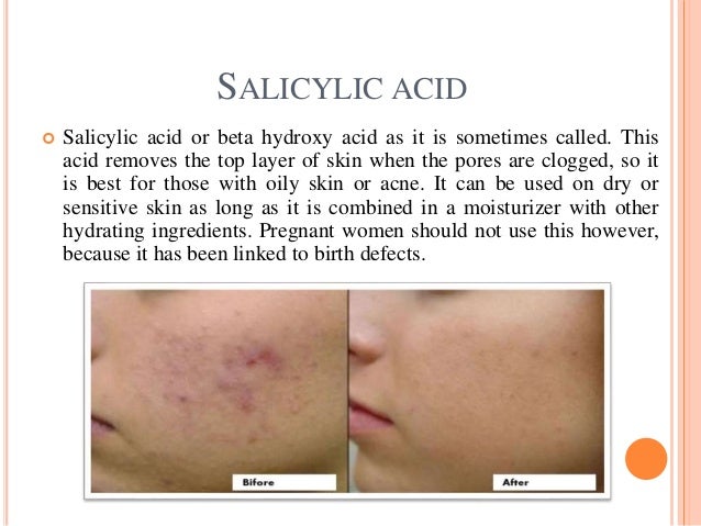 Which acid is right for your skin Which acid is right for your skin