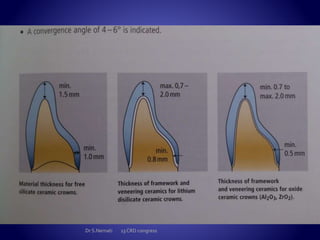  Margins : chamfer / rounded shoulder
 Finish line : even gingivae
 Rounded line angles , no sharp edges
Dr S.Nemati 13 CRD congress
 