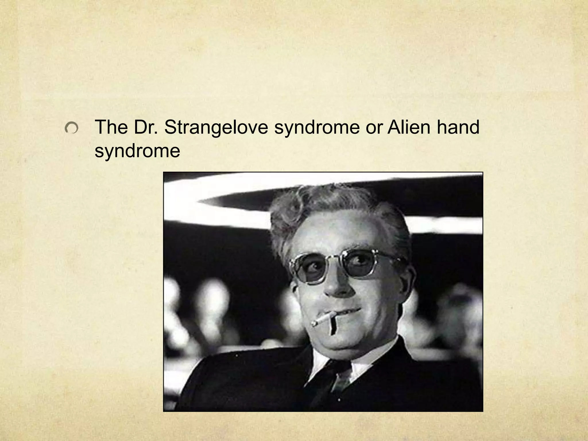 The Dr. Strangelove syndrome or Alien hand
syndrome
 