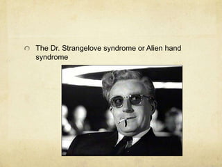 The Dr. Strangelove syndrome or Alien hand
syndrome
 