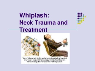 Whiplash:
Neck Trauma and
Treatment
 