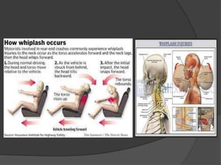 WHIPLASH INJURY SYMPTOMS DIAGNOSIS TREATMENT visual data 3