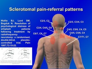 C4 Referral Pattern Whiplash: The ocult damages | PPT
