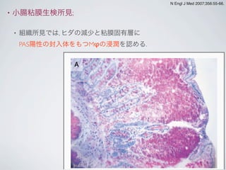 • 小腸粘膜生検所見;
• 組織所見では, ヒダの減少と粘膜固有層に
PAS陽性の封入体をもつMφの浸潤を認める.
medical
A
N Engl J Med 2007;356:55-66.
 
