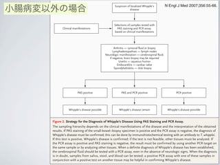 Selections of samples tested with
PAS staining and PCR assay
based on clinical manifestations
Clinical manifestations
Arthritis — synovial fluid or biopsy
Lymphadenopathies — lymph nodes
Neurologic manifestation — cerebrospinal fluid;
if negative, brain biopsy may be required
Uveitis — aqueous humor
Endocarditis — cardiac valve
Spondylodiskitis — disk biopsy
Suspicion of localized Whipple’s
disease
PAS and PCR positivePAS positive
Whipple’s disease possible
PCR positive
Whipple’s disease certain Whipple’s disease possible
Figure 2. Strategy for the Diagnosis of Whipple’s Disease Using PAS Staining and PCR Assay.
The sampling hierarchy depends on the clinical manifestations of the disease and the interpretation of the obtained
results. If PAS staining of the small-bowel–biopsy specimen is positive and the PCR assay is negative, the diagnosis of
Whipple’s disease must be confirmed; this can be done by immunohistochemical testing with an antibody to T. whipplei.
If this test is positive, Whipple’s disease is confirmed; if the test is not feasible, other tissues must be analyzed. If
the PCR assay is positive and PAS staining is negative, the result must be confirmed by using another PCR target on
the same sample or by analyzing other tissues. When a definite diagnosis of Whipple’s disease has been established,
the cerebrospinal fluid should be tested with a PCR assay, even in the absence of neurologic signs. When the diagnosis
is in doubt, samples from saliva, stool, and blood can be tested; a positive PCR assay with one of these samples in
conjunction with a positive test on another tissue may be helpful in confirming Whipple’s disease.
小腸病変以外の場合
N Engl J Med 2007;356:55-66.
 