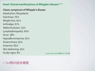 • 764例の症状頻度
France (F Fenollar MD,
Prof D Raoult MD)
Correspondence to:
Dr Verena Moos,
Charité–University Medicine
Berlin, Campus Benjamin
Franklin, Medical departme
Hindenburgdamm 30,
12203 Berlin, Germany.
Tel +49 30 8445 2665;
fax +49 30 8445 4481;
verena.moos@charite.de
Panel: Clinical manifestations ofWhipple’s disease3,14–17
Classic symptoms ofWhipple’s disease
Details from 764 patients
Diarrhoea: 76%
Weight loss: 92%
Arthralgia: 67%
Abdominal pain: 55%
Lymphadenopathy: 60%
Fever: 38%
Hypoalbuminaemia: 91%
Steatorrhoea: 91%
Anaemia: 85%
Skin darkening: 45%
Ocular signs: 8%
Neurological signs (in 10–40% ofWhipple’s disease
patients)
Details from 122 patients
Supranuclear ophthalmoplegia: 32%
Lancet Infect Dis 2008; 8: 179–90
 