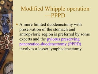 Modified Whipple operation —PPPD A more limited duodenectomy with preservation of the stomach and antropyloric region is preferred by some experts and the  pylorus preserving pancreatico-duodenectomy (PPPD)  involves a lesser lymphadenectomy 