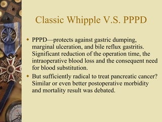 Classic Whipple V.S. PPPD PPPD—protects against gastric dumping, marginal ulceration, and bile reflux gastritis. Significant reduction of the operation time, the intraoperative blood loss and the consequent need for blood substitution.  But sufficiently radical to treat pancreatic cancer? Similar or even better postoperative morbidity and mortality result was debated.  