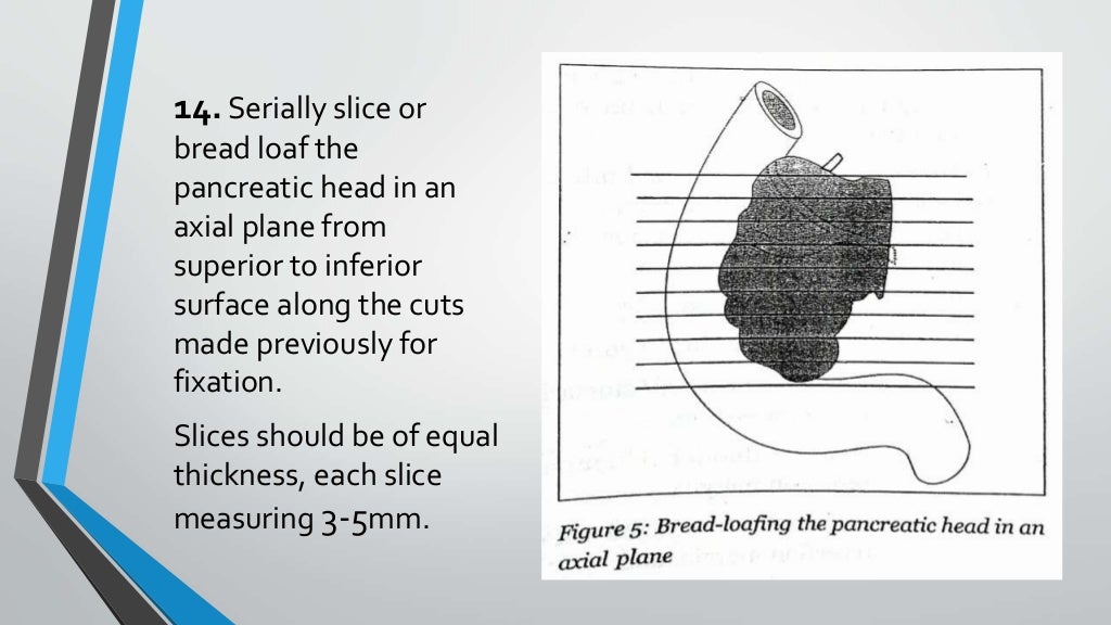 Whipple's specimen grossing