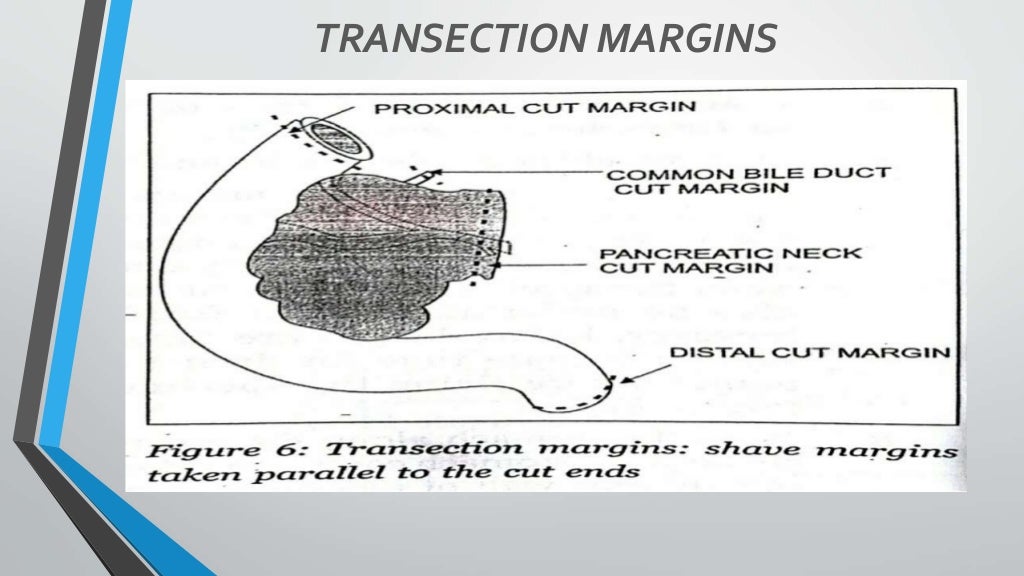 Whipple's specimen grossing