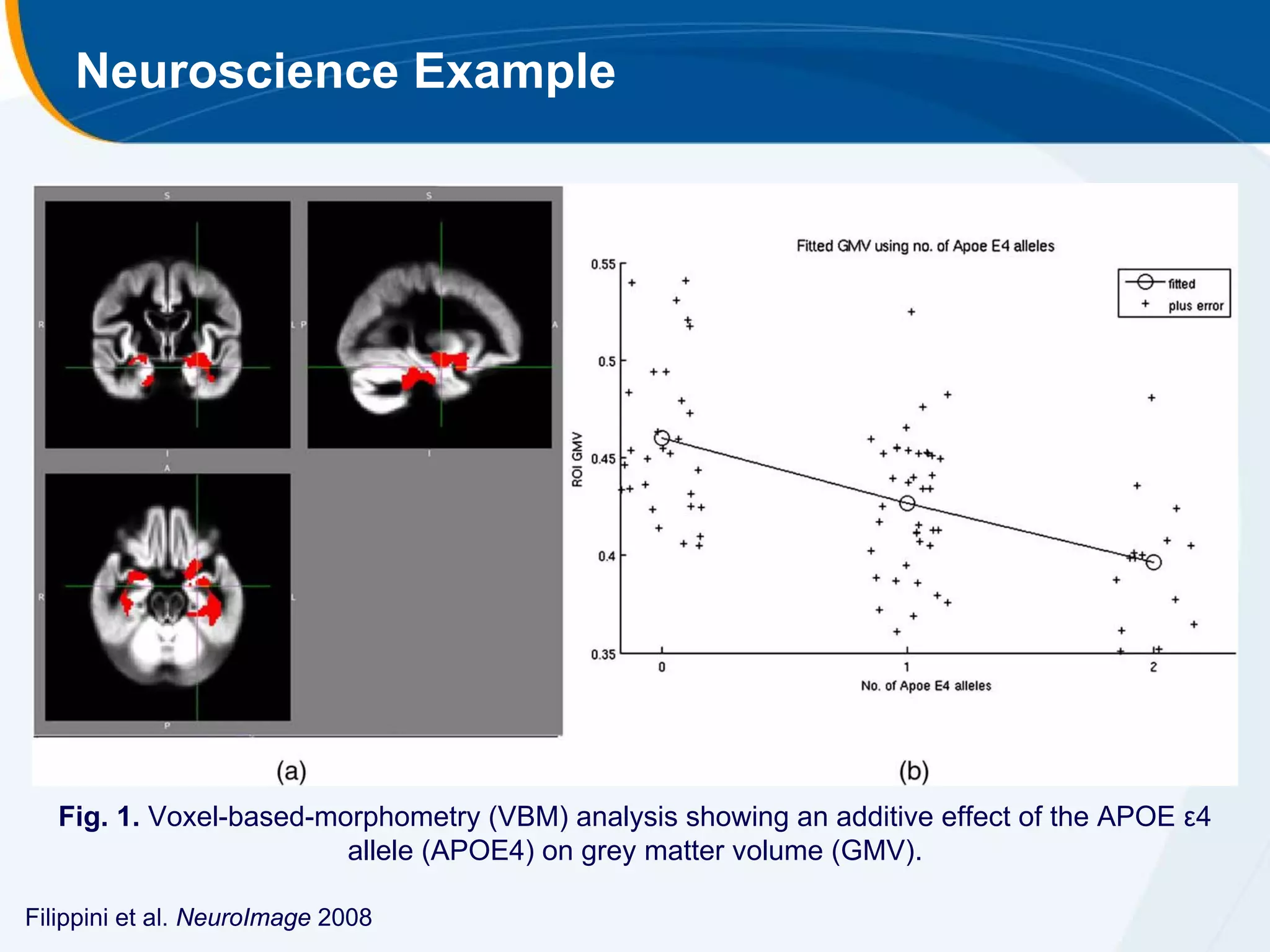 Neuroscience Example




   Fig. 1. Voxel-based-morphometry (VBM) analysis showing an additive effect of the APOE ε4
                         allele (APOE4) on grey matter volume (GMV).

Filippini et al. NeuroImage 2008
 