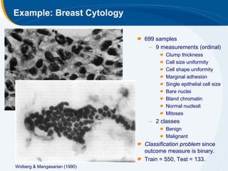 Example: Breast Cytology

                               699 samples
                                – 9 measurements (ordinal)
                                       Clump thickness
                                       Cell size uniformity
                                       Cell shape uniformity
                                       Marginal adhesion
                                       Single epithelial cell size
                                       Bare nuclei
                                       Bland chromatin
                                       Normal nucleoli
                                       Mitoses
                                – 2 classes
                                       Benign
                                       Malignant
                               Classification problem since
                               outcome measure is binary.
                               Train = 550, Test = 133.
Wolberg & Mangasarian (1990)
 