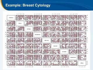 Example: Breast Cytology
 