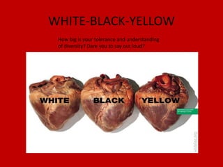 WHITE-BLACK-YELLOW How big is your tolerance and understanding of diversity? Dare you to say out loud? 