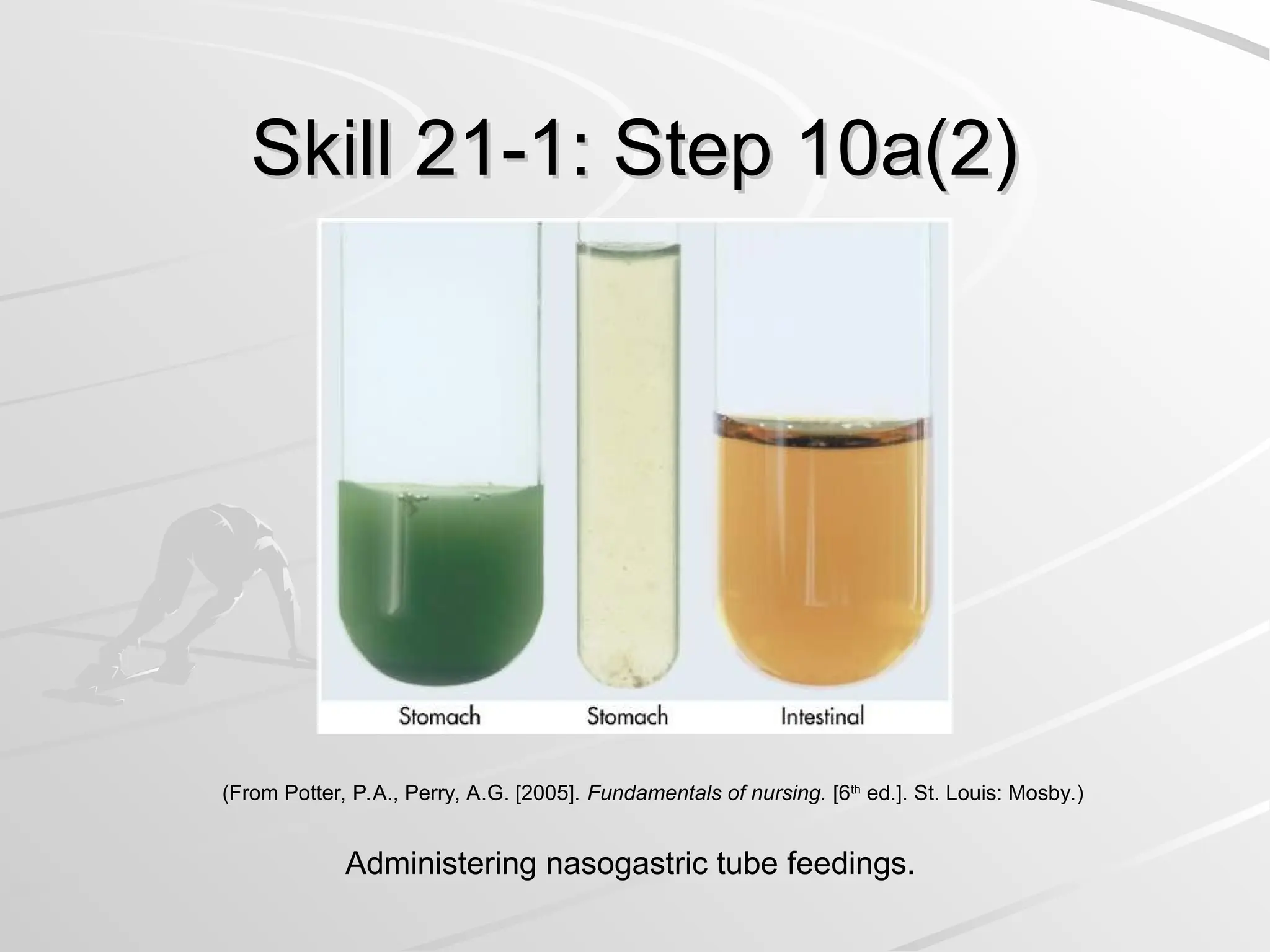 Skill 21-1: Step 10a(2)
Skill 21-1: Step 10a(2)
Administering nasogastric tube feedings.
(From Potter, P.A., Perry, A.G. [2005]. Fundamentals of nursing. [6th
ed.]. St. Louis: Mosby.)
 