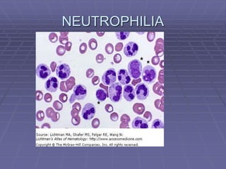 NEUTROPHILIA
 