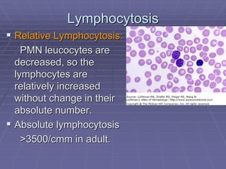 Lymphocytosis
 Relative Lymphocytosis:
PMN leucocytes are
decreased, so the
lymphocytes are
relatively increased
without change in their
absolute number.
 Absolute lymphocytosis
>3500/cmm in adult.
 