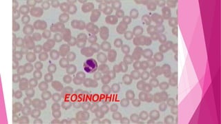 EOSINOPHIL
 