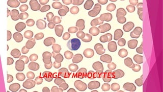 LARGE LYMPHOCYTES
 
