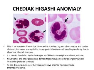 CHEDIAK HIGASHI ANOMALY
• This as an autosomal recessive disease characterized by partial cutaneous and ocular
albinism, increased susceptibility to pyogenic infections and bleeding tendency due to
abnormal platelet function.
• It is due to the defect in the leukocyte NADPH oxidase-respiratory burst, oxidase.
• Neutrophils and their precursors demonstrate inclusion like large single/multiple
lysosomal granules (arrows).
• As the disease progresses, there is progressive anemia, neutropenia &
thrombocytopenia.
 