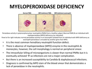 MYELOPEROXIDASE DEFICIENCY
• It is the most common hereditary neutrophil function defect.
• There is absence of myeloperoxidase (MPO) enzyme in the neutrophils &
monocytes, however, the cell morphology is normal on peripheral smear.
• The intracellular killing of microorganisms is slower than normal PMNs but it is
eventually achieved  so infections are not a major complication.
• But there is an increased susceptibility to Candida & staphylococcal infections.
• Diagnosis is confirmed by MPO stain of the blood smear that demonstrates a
lack of peroxidase in the neutrophils.
Peroxidase activity in polymorphonuclear neutrophils (PMN) from a healthy subject (Normal PMN) & an individual with
myeloperoxidase (MPO) deficiency (as indicated).
Panel at far right indicates normal peroxidase activity in an eosinophil isolated from an individual with MPO deficiency as
eosinophil peroxidase is encoded by another gene than MPO.
 