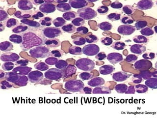White Blood Cell (WBC) Disorders
By
Dr. Varughese George
 